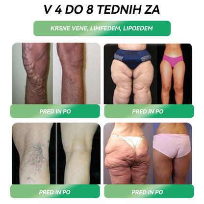 𝑆𝑇𝐷𝐸𝐼® 𝐺𝐿𝑃-1 𝐼𝑧𝑔𝑢𝑏𝑎 𝑇𝑒ž𝑒 𝑈𝑠𝑡𝑛𝑎 𝑅𝑒š𝑖𝑡𝑒𝑣 - Debelost, bolezni srca in ožilja, diabetes, spalna apneja, težave s sklepi in še več💎